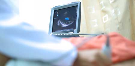 Feature image for School recruiting for a Curriculum Lead Editor for the Echocardiography Training Programme